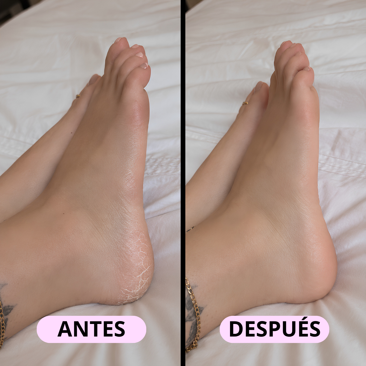 HeelCare Pro™