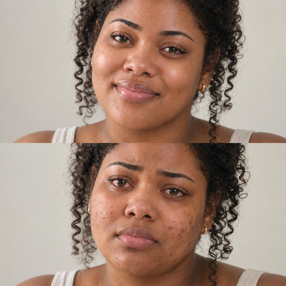 Nurais Skin Tone